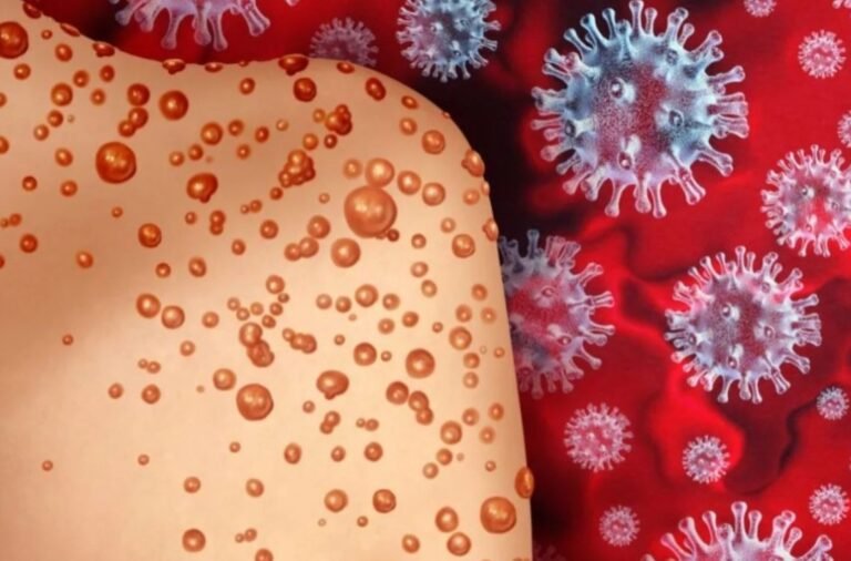 HEALTH | మంకీపాక్స్ కు వ్యాక్సిన్‌