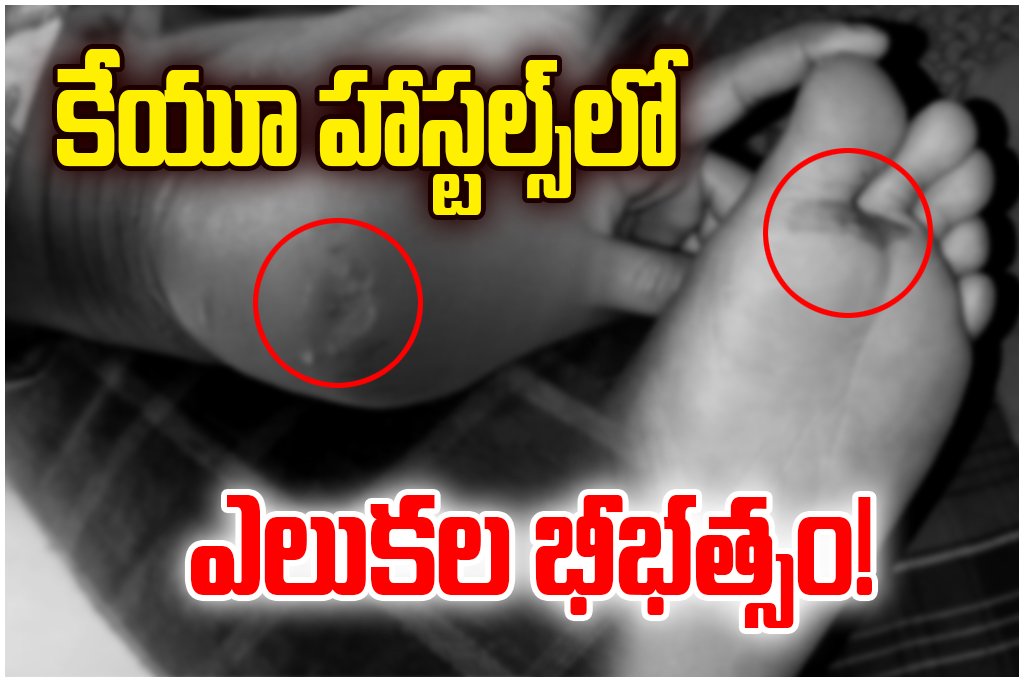 Rat attacks in Kakatiya University hostels scare students as poor sanitation raises safety concerns on campus.