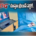 Guntur Awake Brain Surgery