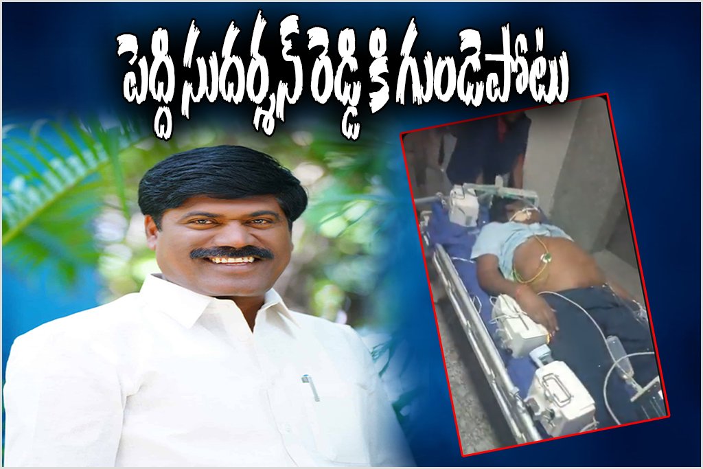 Peddi Sudarshan Reddy Health