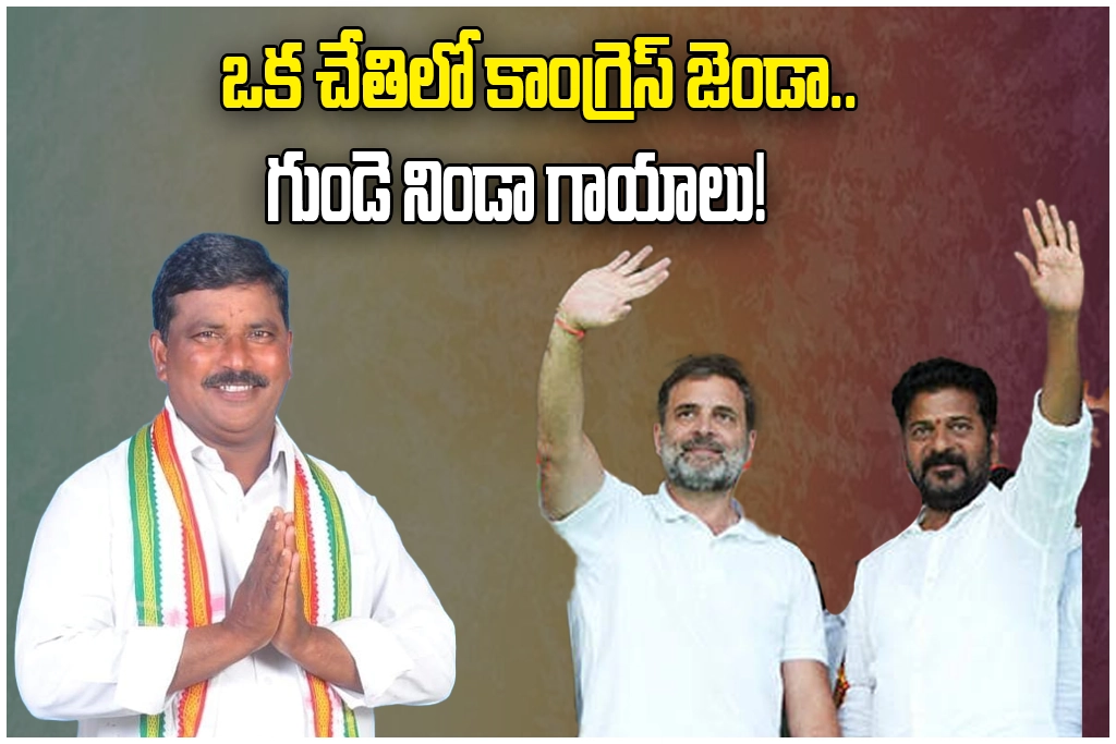 Palakurthi Congress Internal Dispute