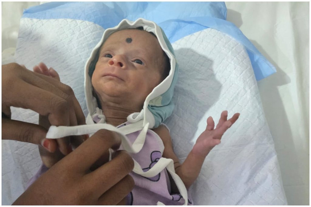 800 Gram Baby Treatment