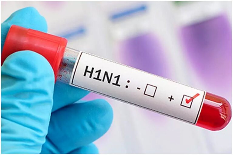 Chhattisgarh Swine Flu Cases