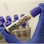 Chhattisgarh Swine Flu Cases