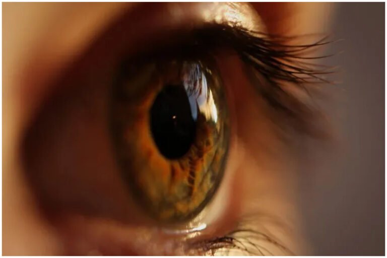 Corneal Blindness India Eye Donation