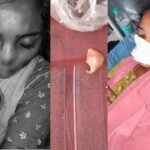 Husband Bites Wife Nose