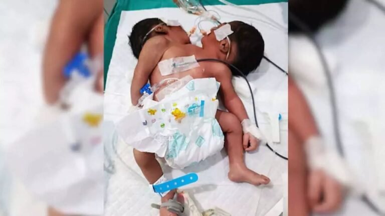 Odisha Twin Babies Death